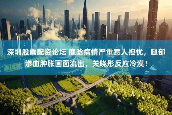 深圳股票配资论坛 鹿晗病情严重惹人担忧，腿部渗血肿胀画面流出，关晓彤反应冷漠！